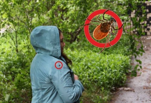 188 елабужан пострадали от укусов клещей