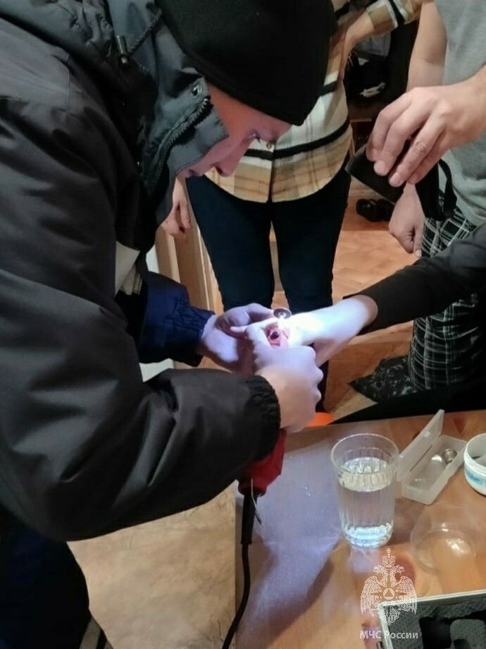 В Казани спасатели помогли снять с пальца девочки застрявшее кольцо